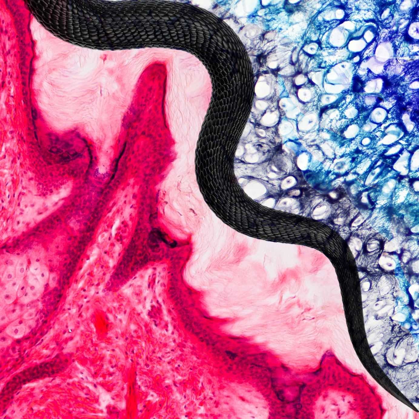 A black snake slithering between cellular substances. The bottom left cells are hot pink and densely fibered. The top-right cells are large white spots in between various shades of blue