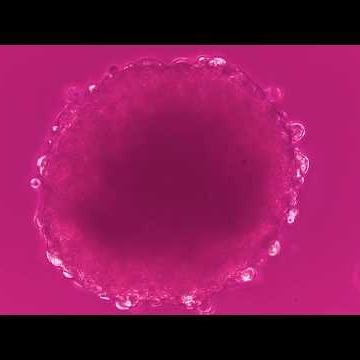 Preview image for the video ""In Astral Reticles"".