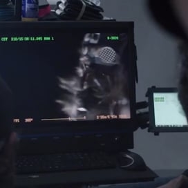 Preview image for the video "Interview (Video) for  by WeareKash".